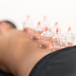 Cupping Massage